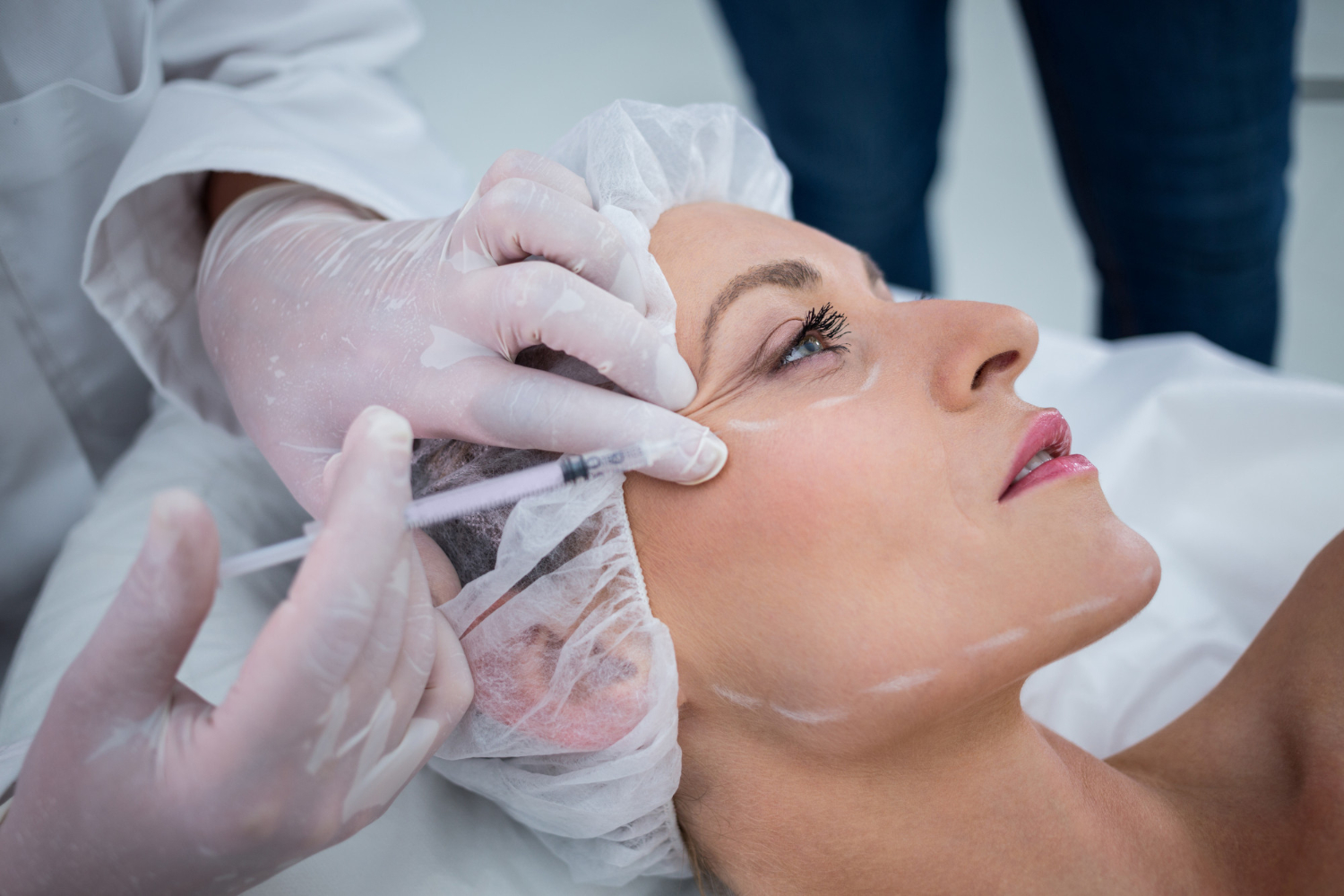 Combining Botox with Other Treatments for a Youthful Glow