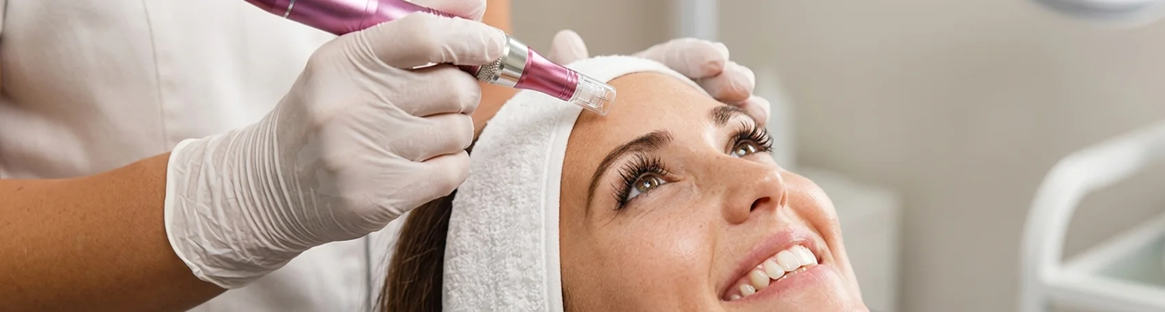 Find the Best Microneedling Treatment for Radiant Skin