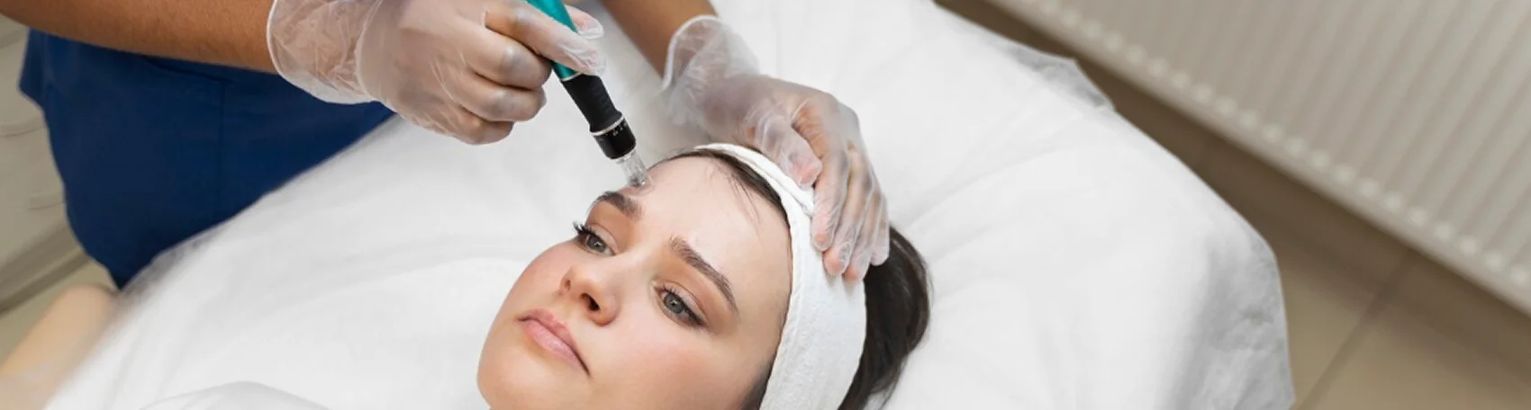 Try Microneedling with SkinPen for Acne & Wrinkles
