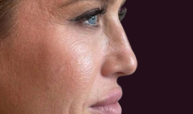 Visible Transformation, Real Results After