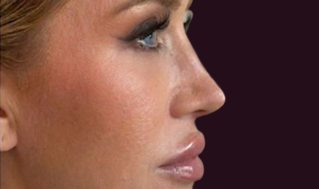 Visible Transformation, Real Results Before