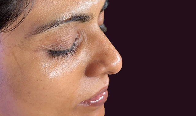 Visible Transformation, Real Results After