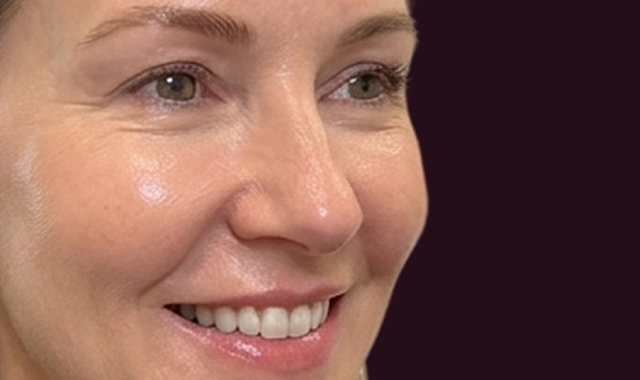 Visible Transformation, Real Results After