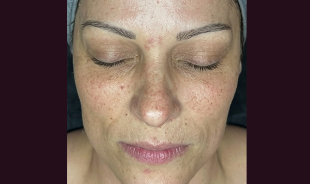 Visible Transformation, Real Results After