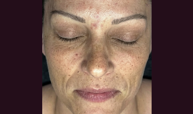 Visible Transformation, Real Results Before