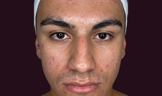 Visible Transformation, Real Results Before
