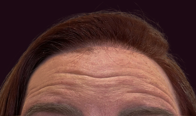 Visible Transformation, Real Results Before