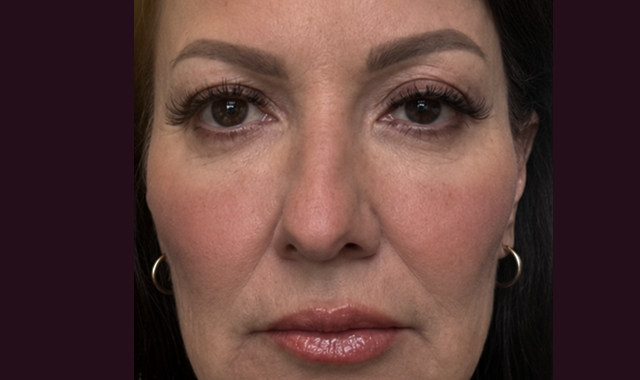 Visible Transformation, Real Results Before