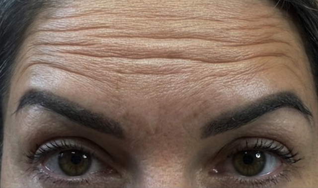 Visible Transformation, Real Results Before
