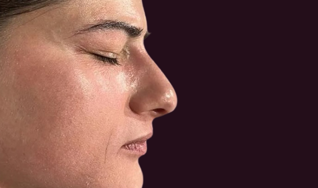 Visible Transformation, Real Results After