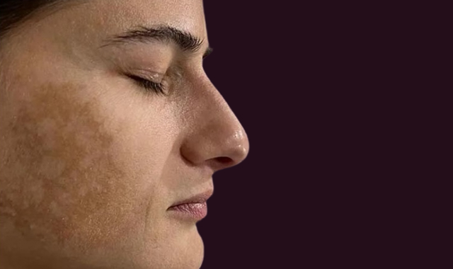 Visible Transformation, Real Results Before