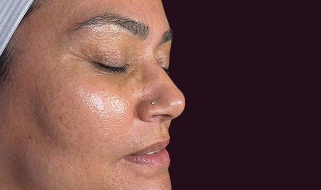 Visible Transformation, Real Results After