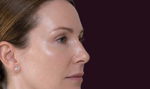 Visible Transformation, Real Results After