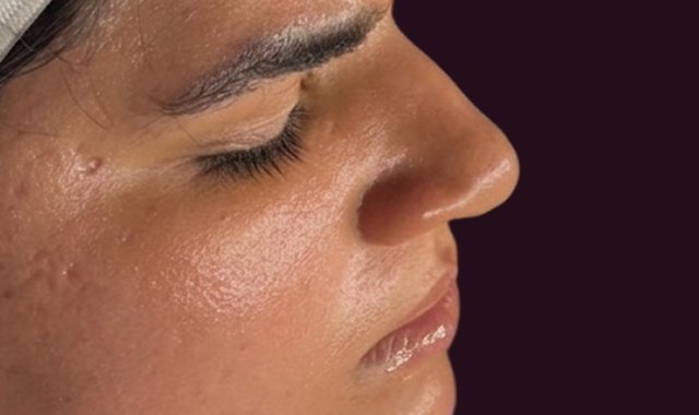 Visible Transformation, Real Results After