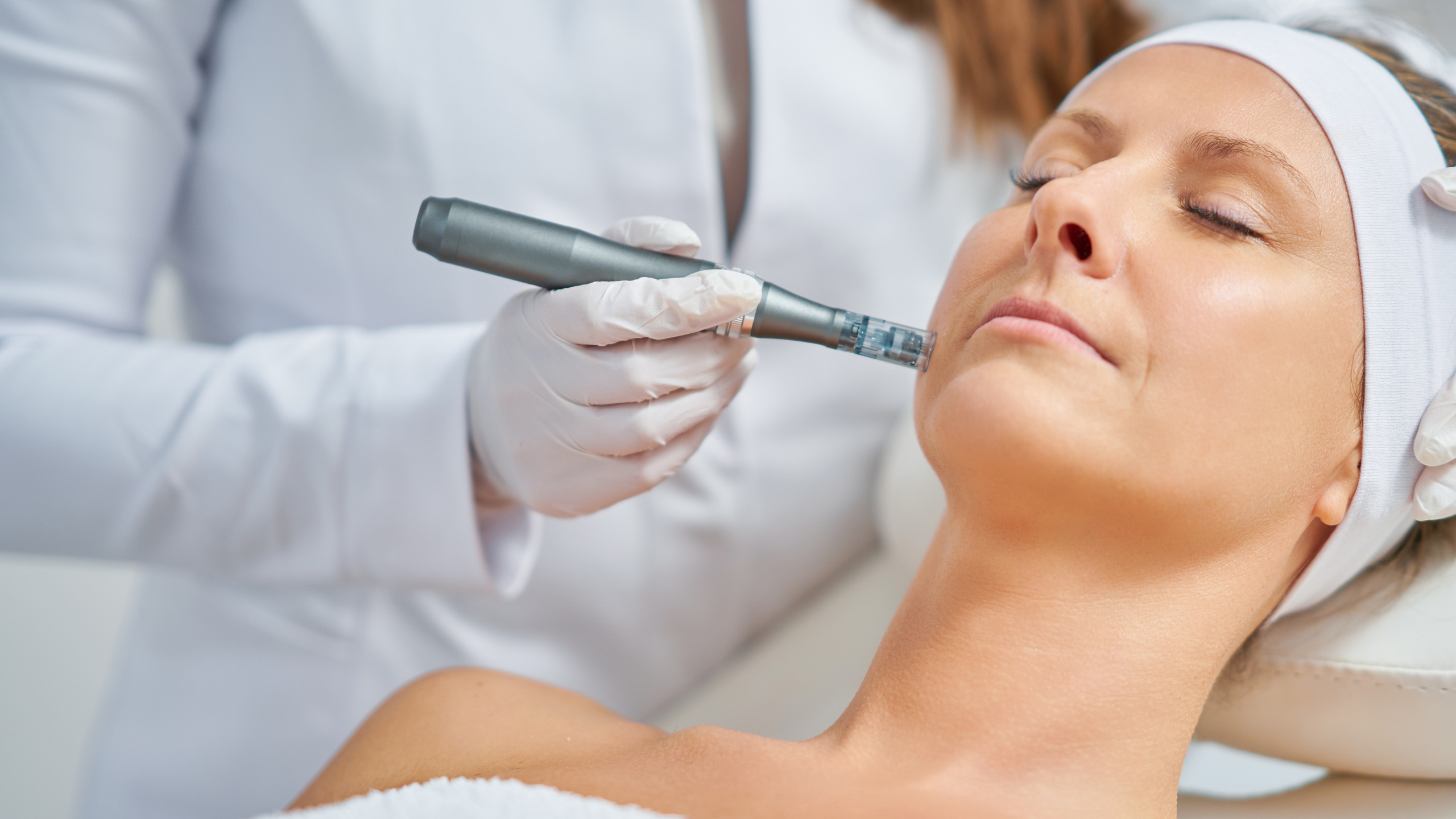 Microneedling with SkinPen: Benefits and Tips