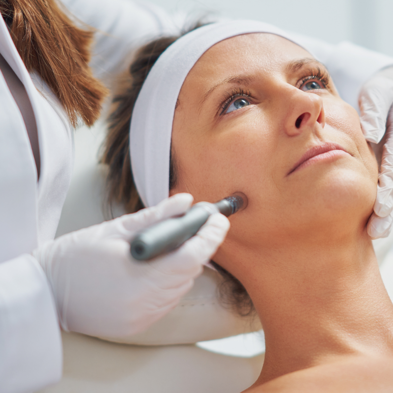 Microneedling Treatment: Considerations and Tips
