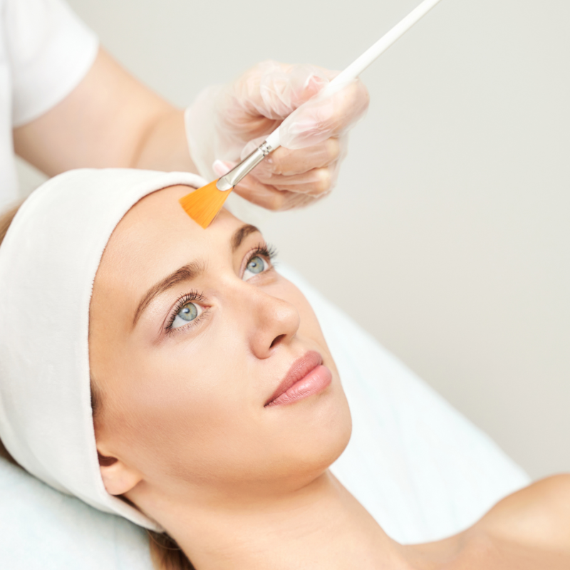 Chemical Peels at Purple Basil Medspa - Types & Prep