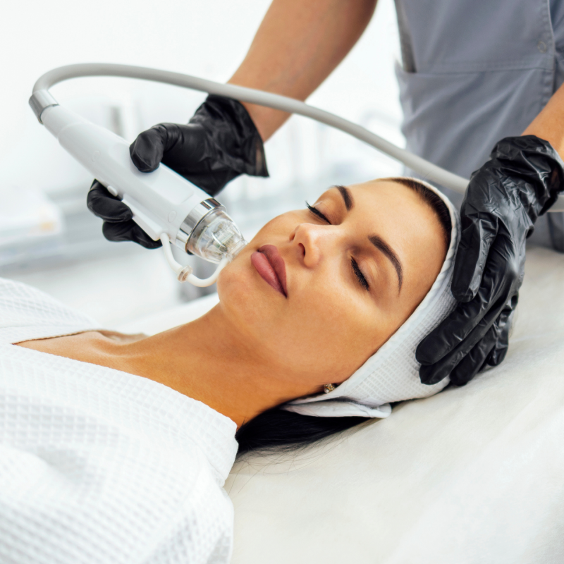 RF Microneedling at Purple Basil Medspa