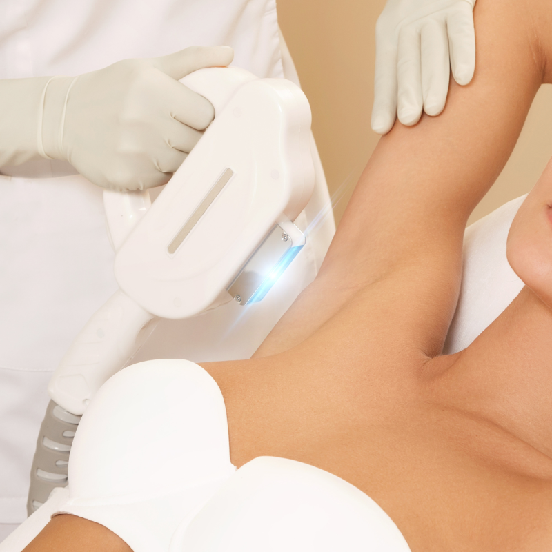 Painless Face Laser Hair Removal - Affordable Services