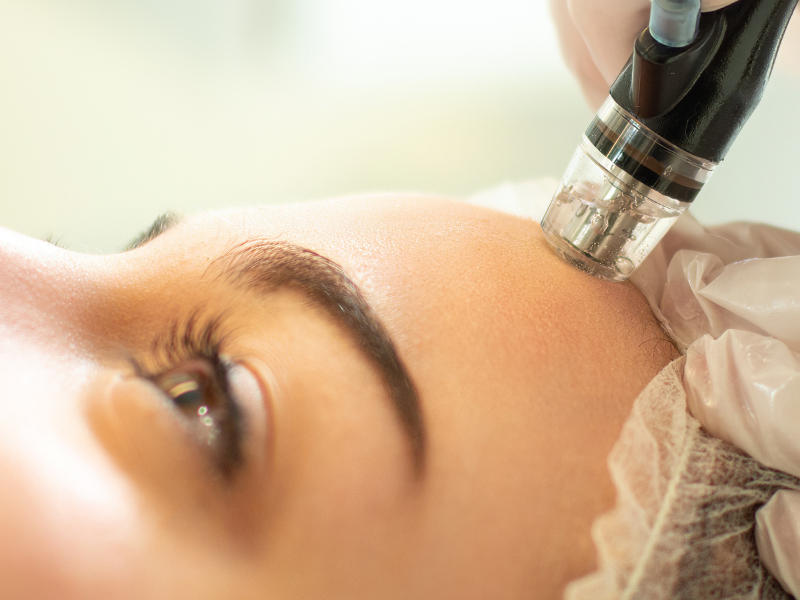Hydrafacial for Healthy Skin & Addressing Concerns