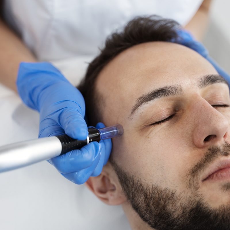 Microneedling near me