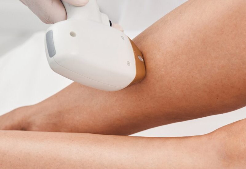 Laser Hair Removal Session