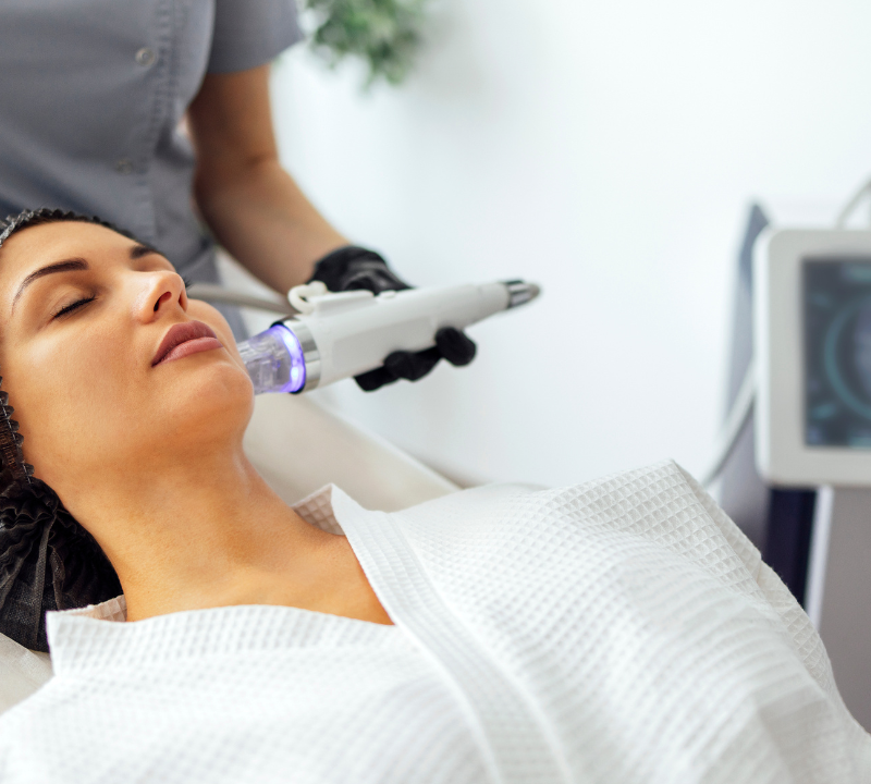 RF Microneedling: Skin Tightening & Benefits