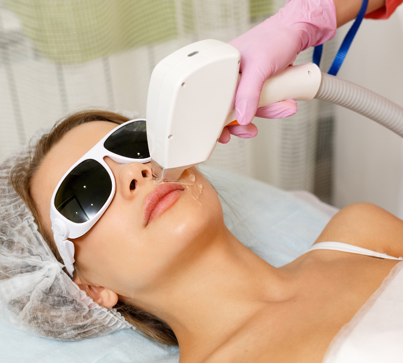 Forget Waxing: Painless Laser Hair Removal for All Areas