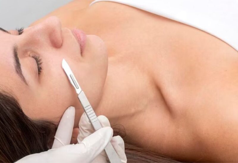 Is Dermaplaning Safe for Sensitive Skin